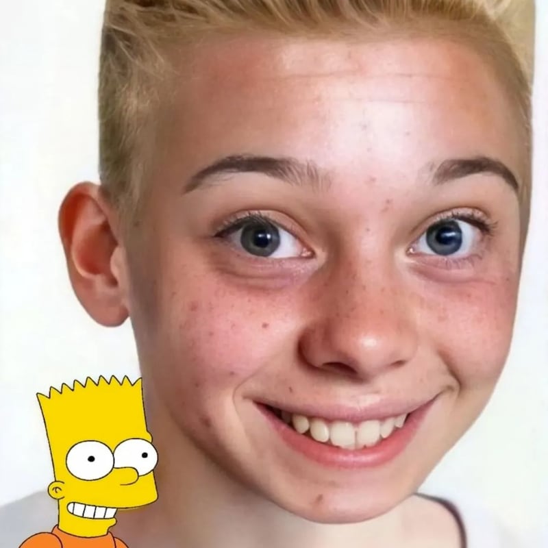 Bart